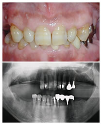 �����̊��ݍ��킹���Ȃ����f�̃����g�Q��