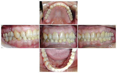 ���Ì�̎ʐ^�㉺���E