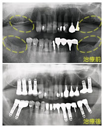 12�{�̃C���v�����g