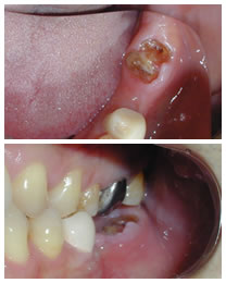 �C���v�����g���ÑO