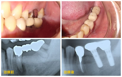 ���Ì�̃C���v�����g