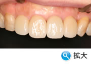 ���Ì�̃C���v�����g�g��ʐ^