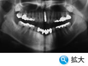 �C���v�����g�p�m���}�ʐ^