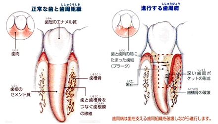 �����g�D�̔�r