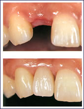 �����P�{�������ꍇ