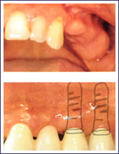 ���{�̎����������ꍇ