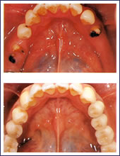 ���̂Ȃ��������L���ꍇ