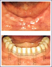 �����S���Ȃ��ꍇ