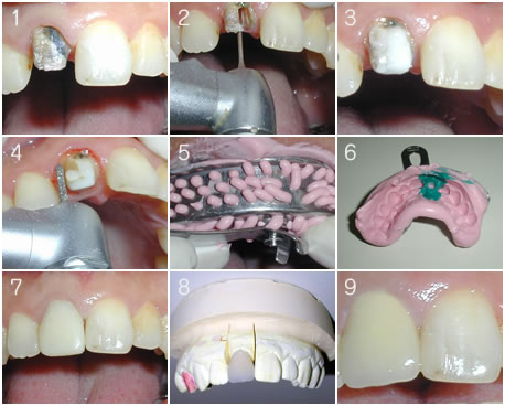 �O�����̎���